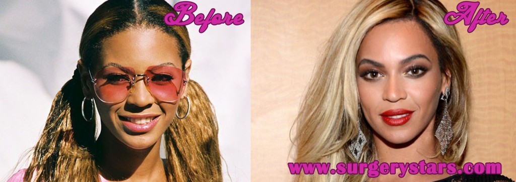 Beyonce Nose Job