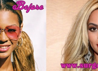 Beyonce Nose Job