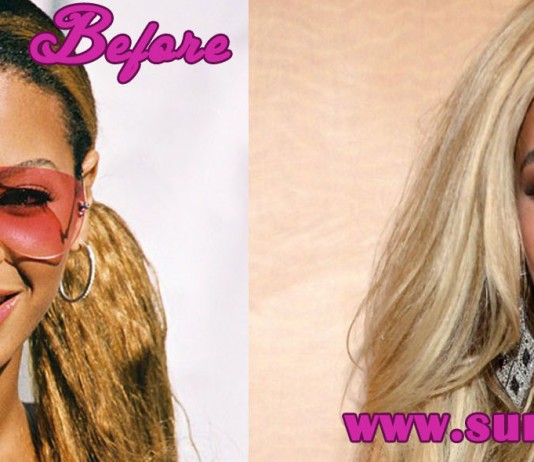 Beyonce Nose Job