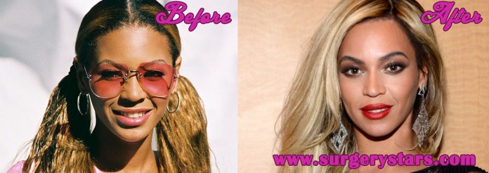 Beyonce Nose Job