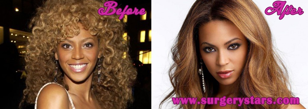 Beyonce Plastic Surgery Before And After Pictures