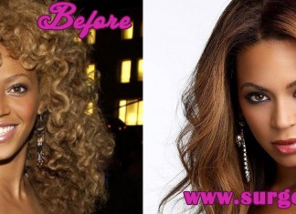 Beyonce Plastic Surgery