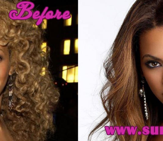 Beyonce Plastic Surgery