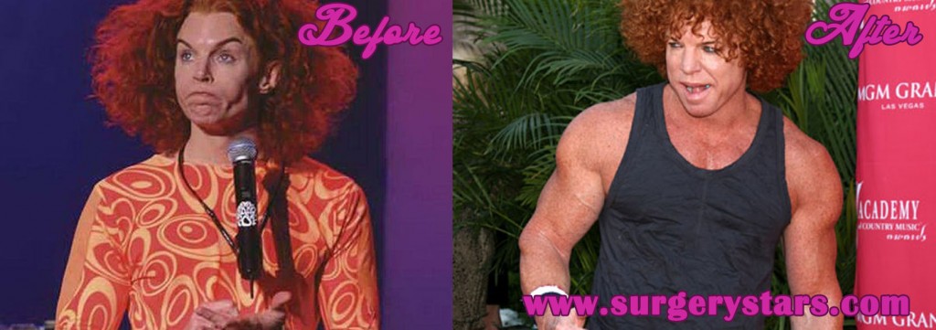 Carrot Top Steriods