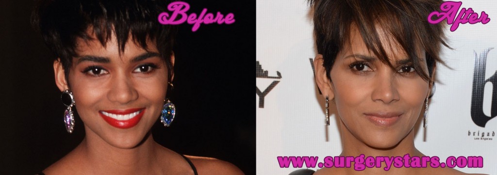 Halle Berry Nose Job