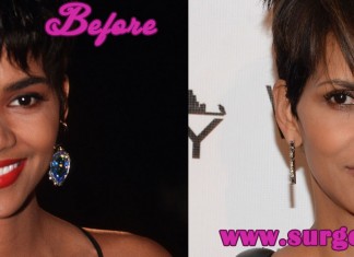 Halle Berry Nose Job