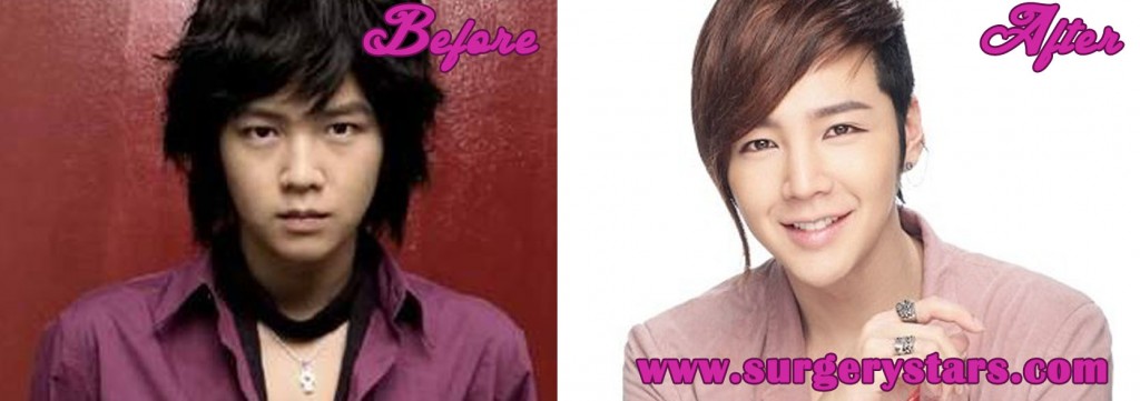 Jang Geun Suk Plastic Surgery