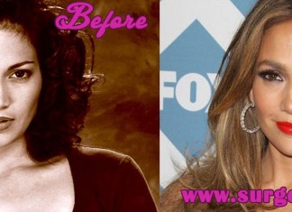 Jennifer Lopez Nose Job