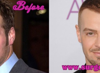 Joey Lawrence Hair