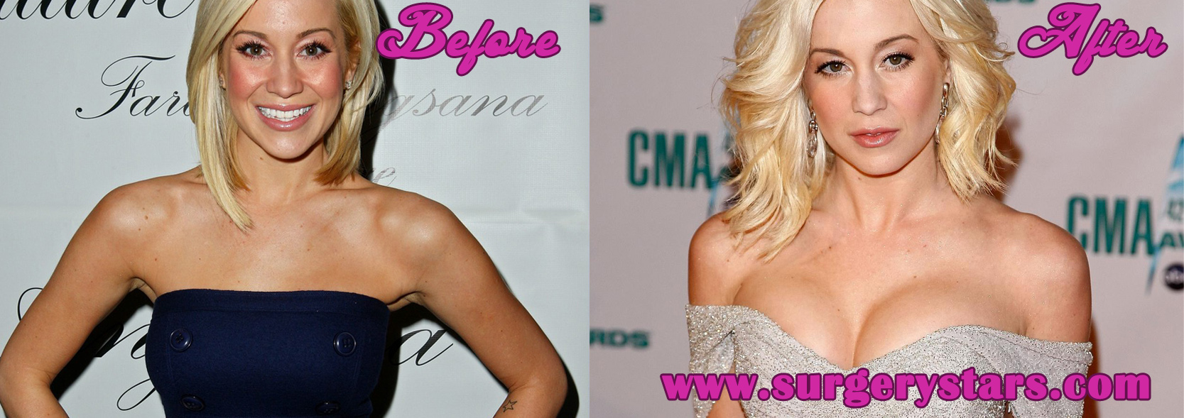 Kellie Pickler Boobs - Before and After Pictures.
