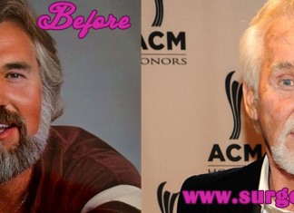Kenny Rogers Facelift