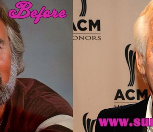 Kenny Rogers Facelift