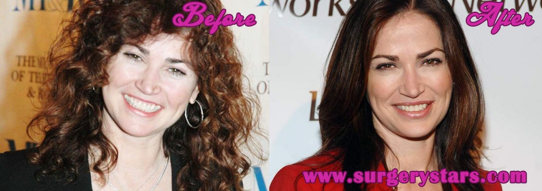 Kim Delaney Plastic Surgery Before And After Botox In Vrogue Co