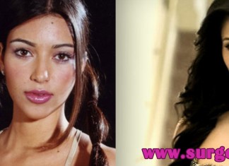 Kim Kardashian Before and After