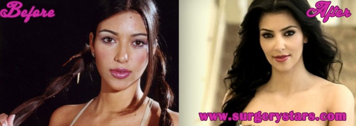 Kim Kardashian Before and After