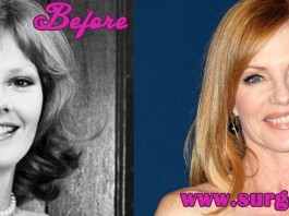 Marg Helgenberger Plastic Surgery