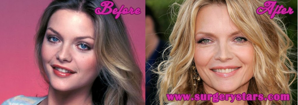 Michelle Pfeiffer Plastic Surgery