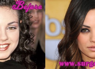Mila Kunis Nose Job