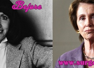 Nancy Pelosi Plastic Surgery