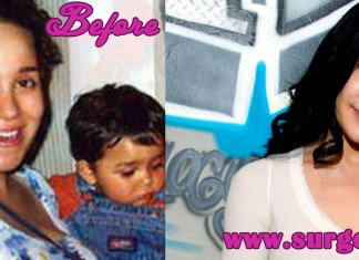 Octomom Plastic Surgery