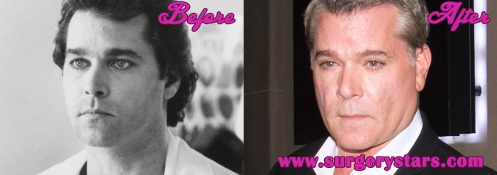 Ray Liotta Plastic Surgery