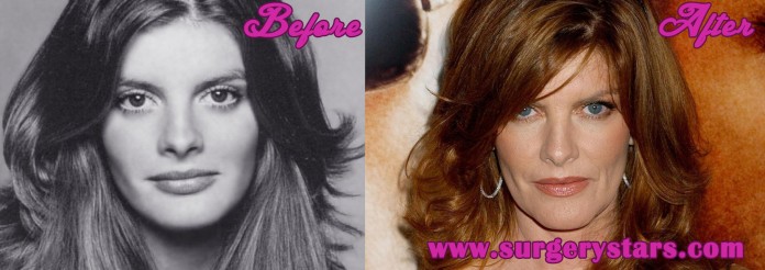 Rene Russo Plastic Surgery