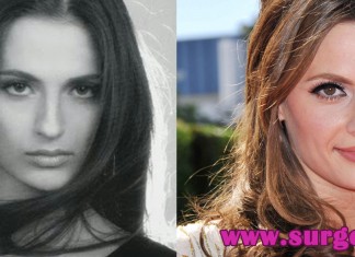 Stana Katic Nose Job