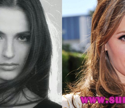 Stana Katic Nose Job