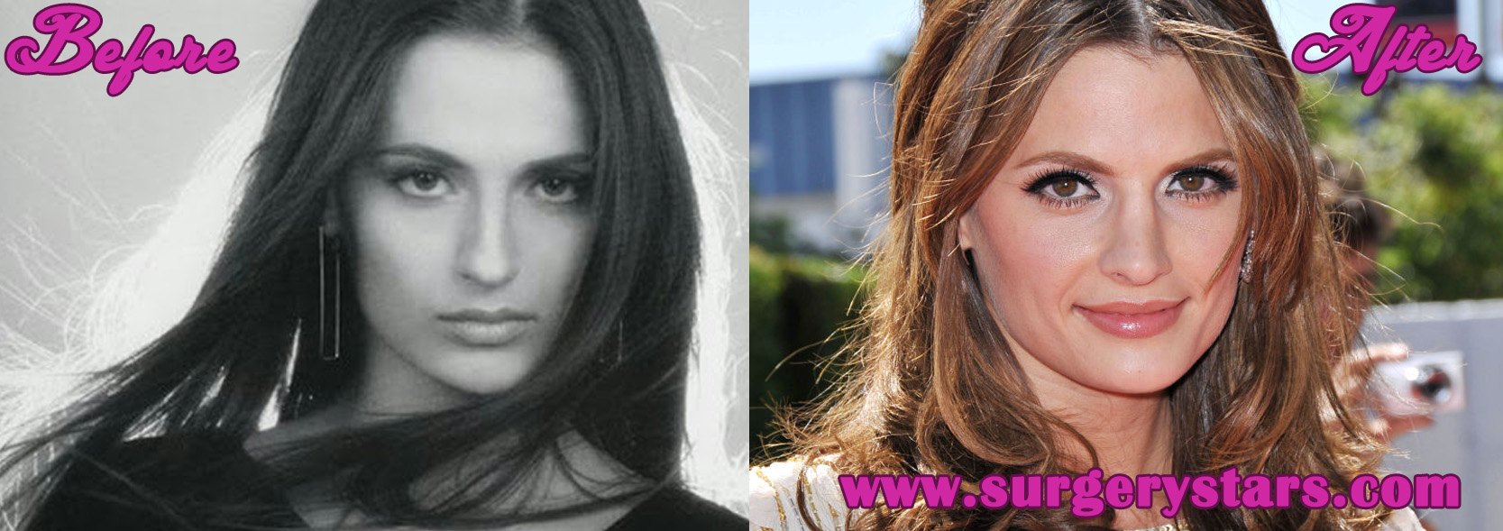 Stana Katic Nose Job - Before and After Pictures.