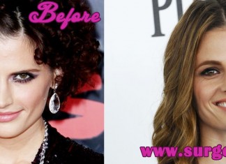 Stana Katic Plastic Surgery
