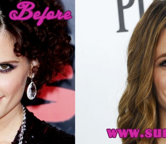 Stana Katic Plastic Surgery