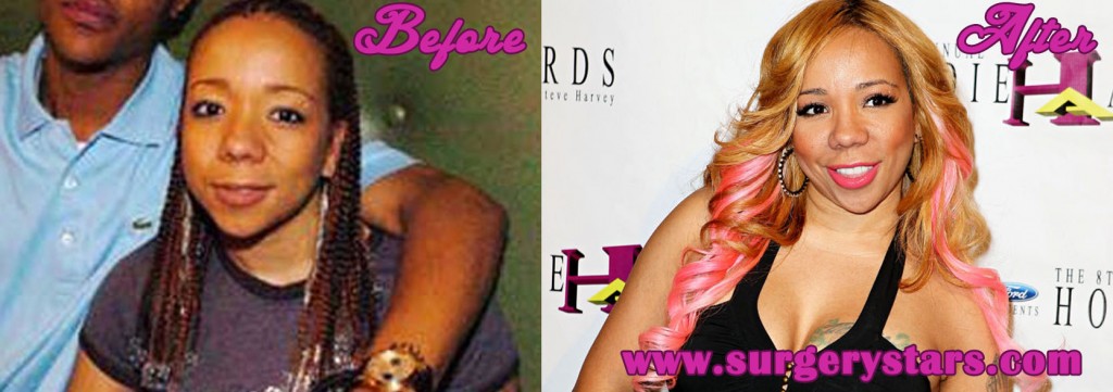 Tameka Cottle Plastic Surgery