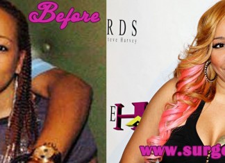Tameka Cottle Plastic Surgery