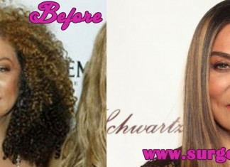 Tina Knowles Plastic Surgery