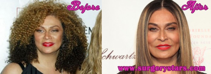 Tina Knowles Plastic Surgery