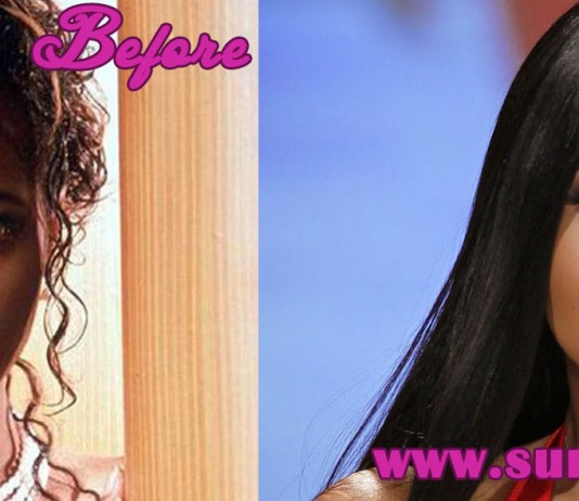 Toni Braxton Plastic Surgery
