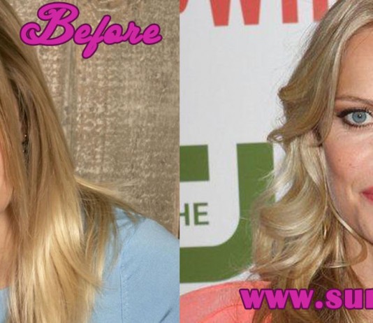 Mircea Monroe Plastic Surgery