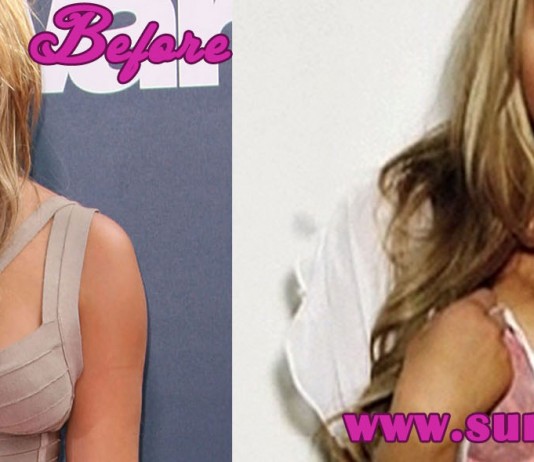 Amanda Bynes Boob Job