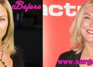 Amanda Redman Plastic Surgery