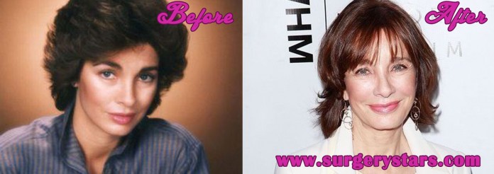 Anne Archer Plastic Surgery