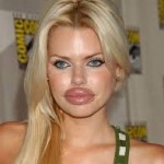 celebrity plastic surgery gonewrong