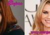 Claire Danes Plastic Surgery