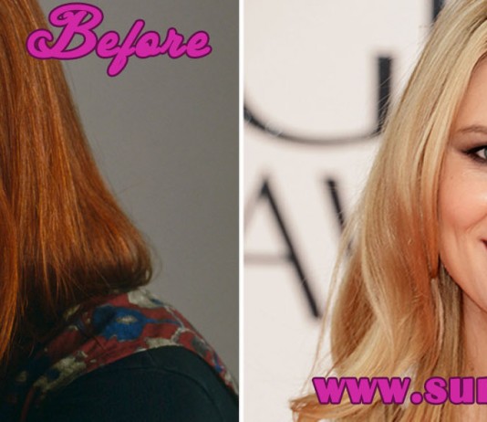 Claire Danes Plastic Surgery