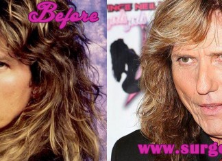 David Coverdale Plastic Surgery