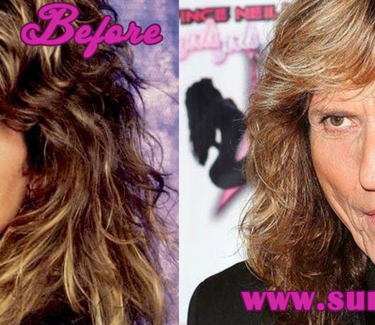 David Coverdale Plastic Surgery