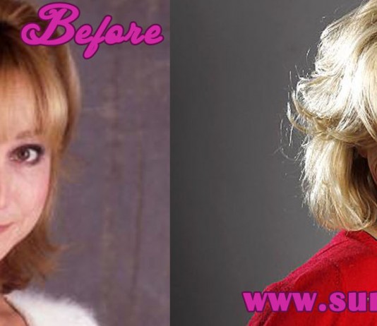 Felicity Kendal Plastic Surgery