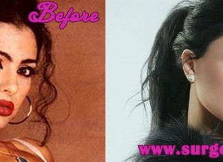 Haifa Wehbe Plastic Surgery