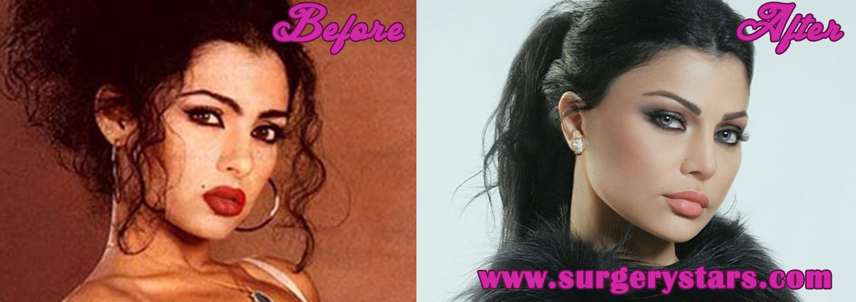 Haifa Wehbe Plastic Surgery - Before and After Pictures.