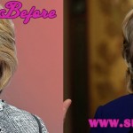 Hillary Clinton Facelift