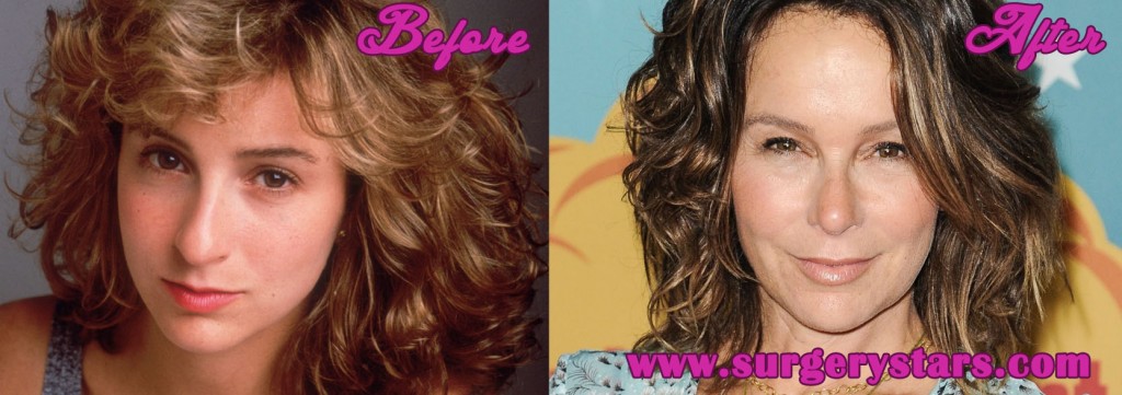 Jennifer Grey Plastic Surgery